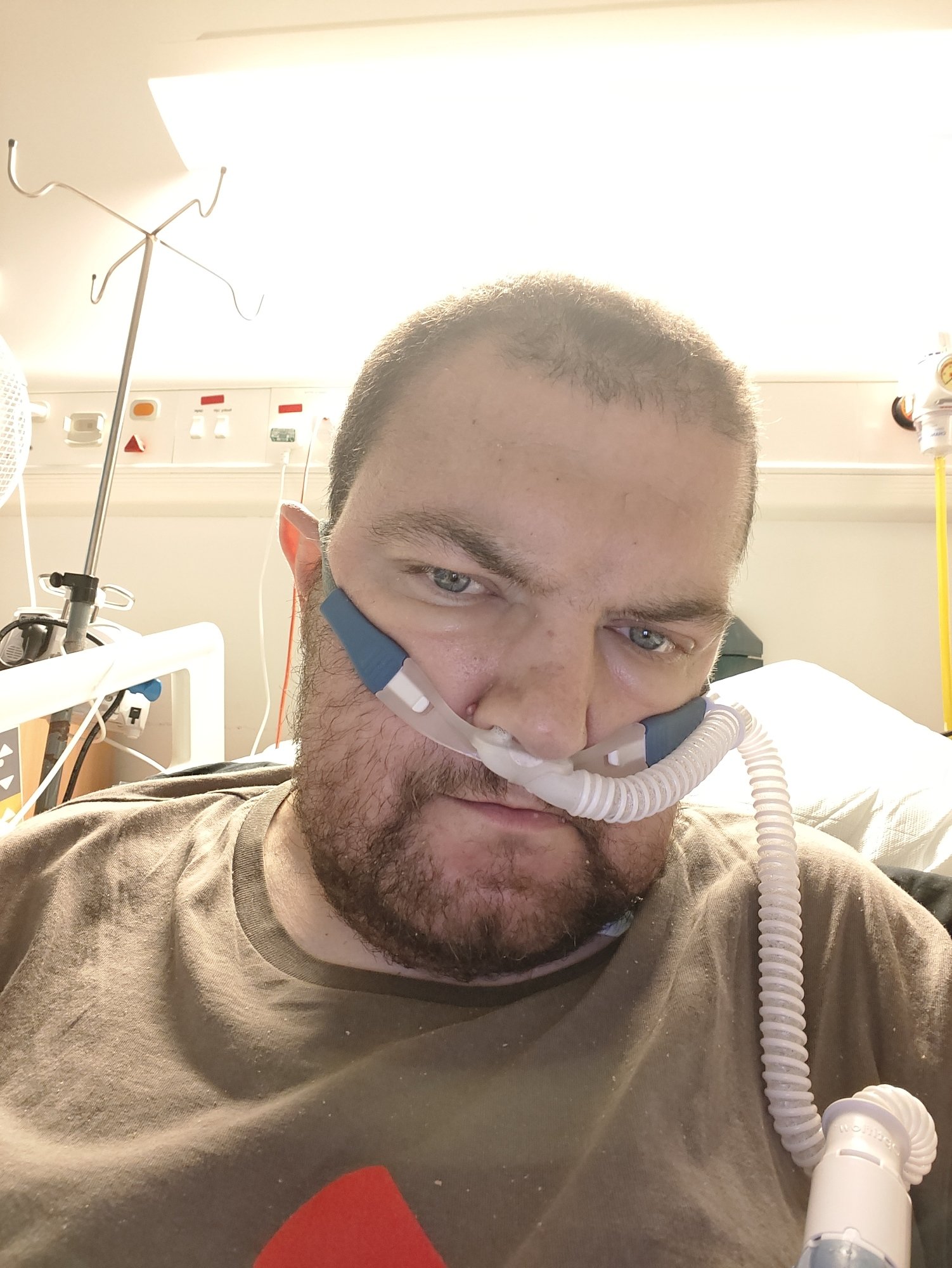 A picture of me, 39 year old man, in a grey t shirt, with an oxygen mask, of the spectacles type 