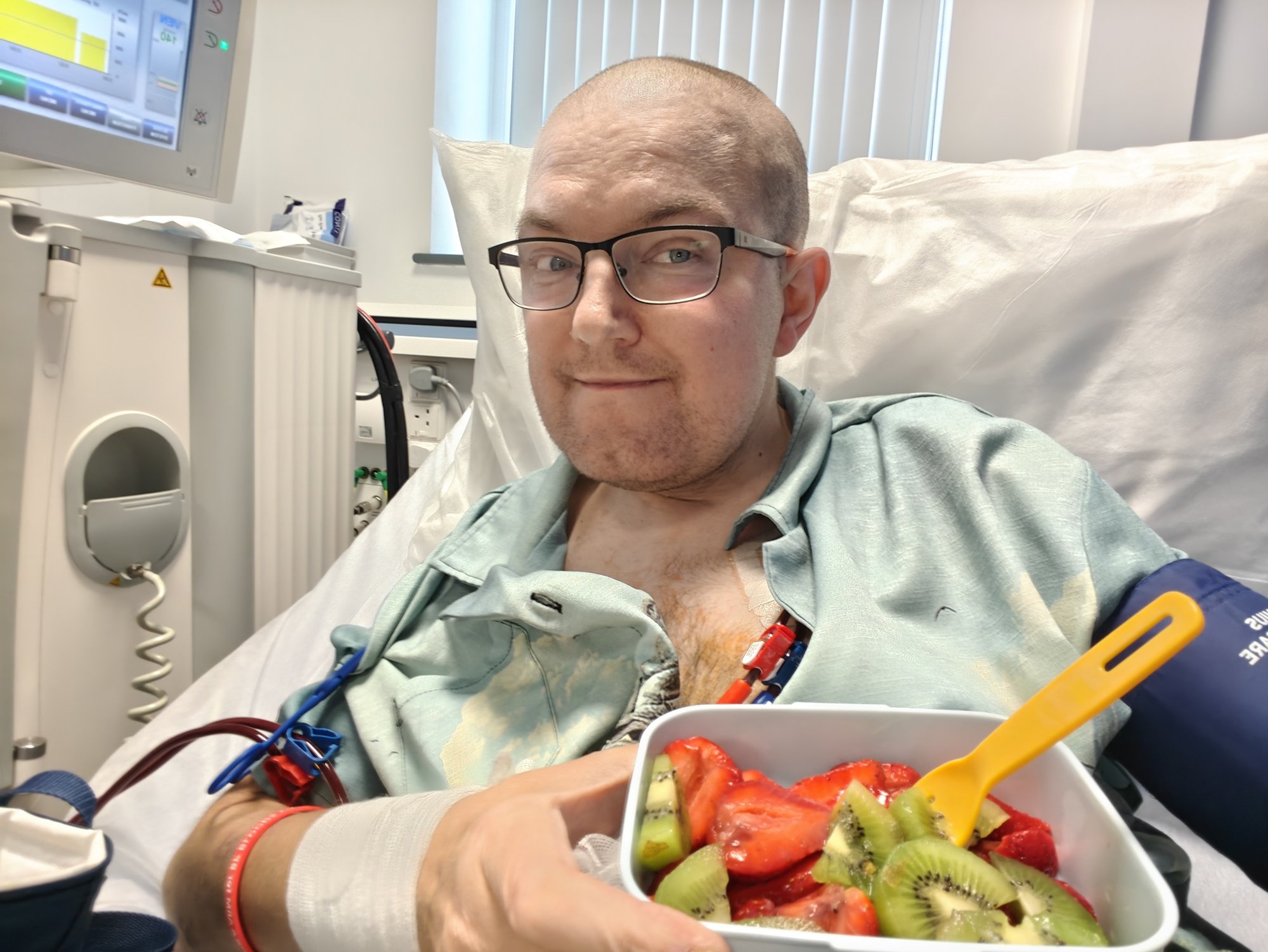 A picture of me, a white, bald headed, 40-year old man with glasses, sitting in a dialysis bed. I am eating from a plastic container that has strawberries and kiwi in it. I am wearing a light bluey green shirt. Two tubes are coming out of my chest which is where the dialysis machine is connected. A blood pressure cuff sits on my right arm. I have a wry smile on my face. Just off to the right there is the edge of the dialysis machine visible. 