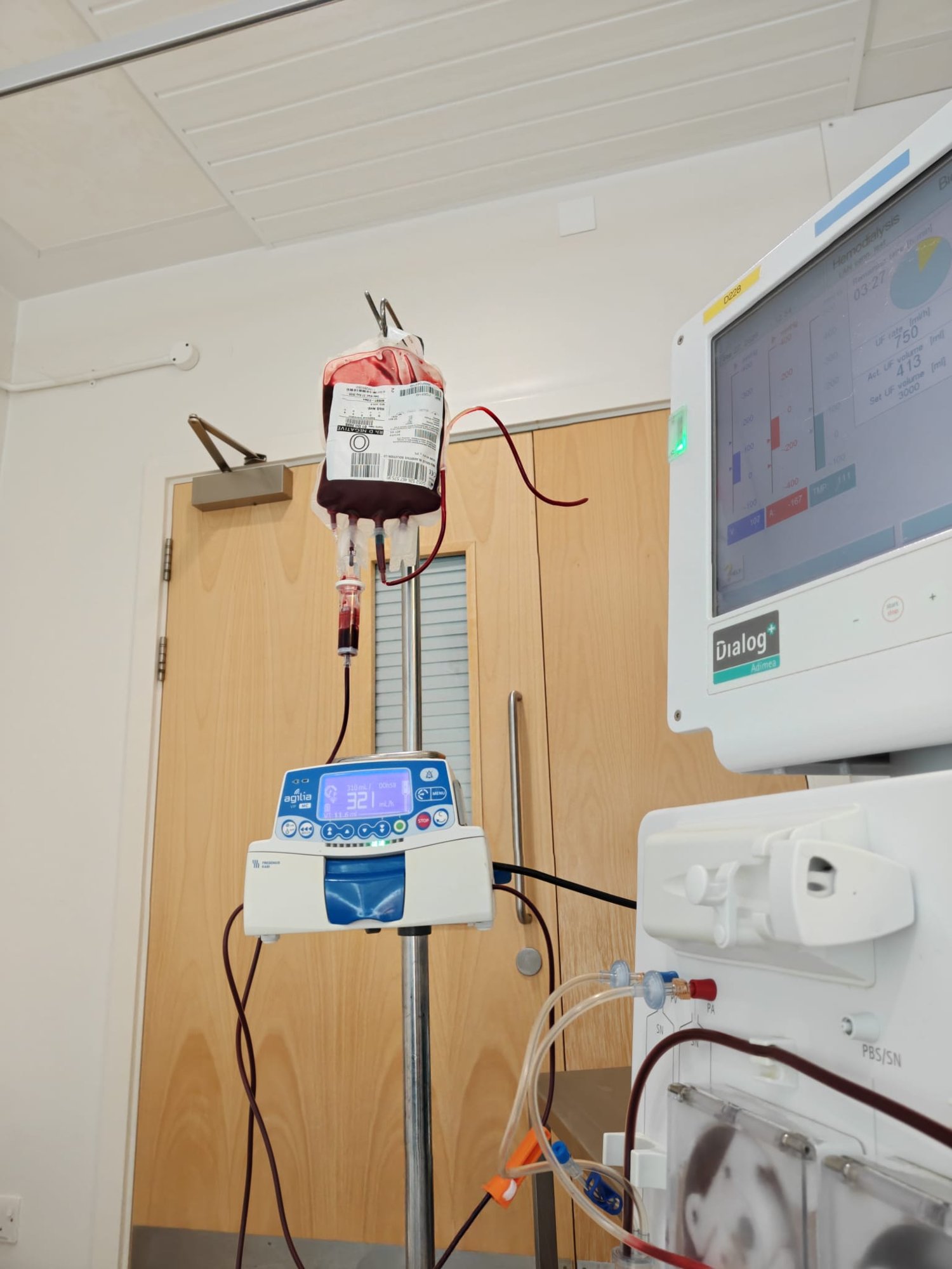 A picture of a bag of blood, being transfused. The blood is next to an active dialysis machine.